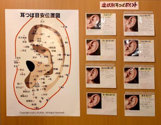 耳ツボ画像
